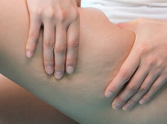 Il corso “Massaggio circolatorio: applicazione anticellulite” in avvio a febbraio 2023